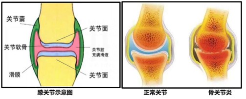 膝關節(jié)示意圖